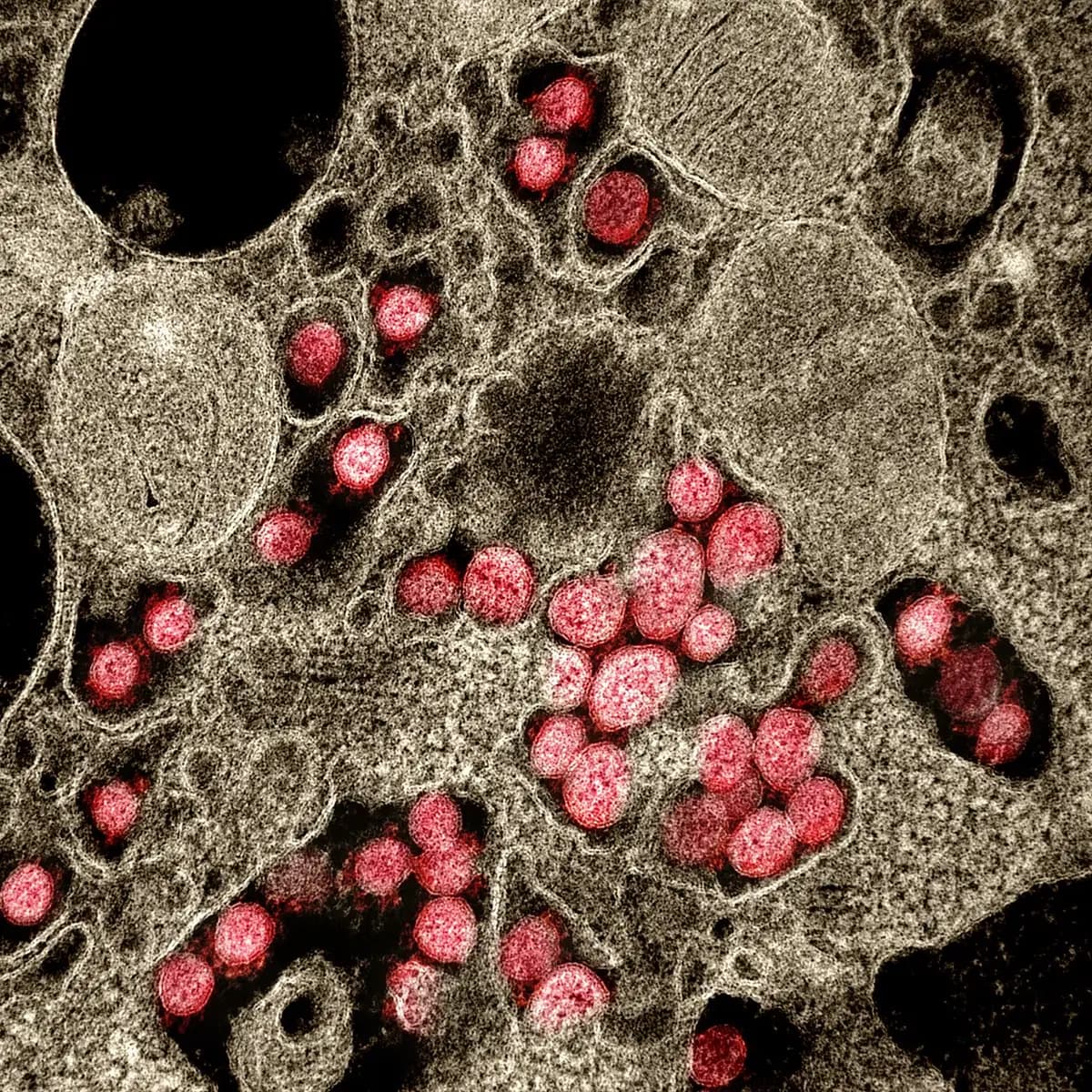 Electron micrograph of a cell packed with round virus particles, coloured red